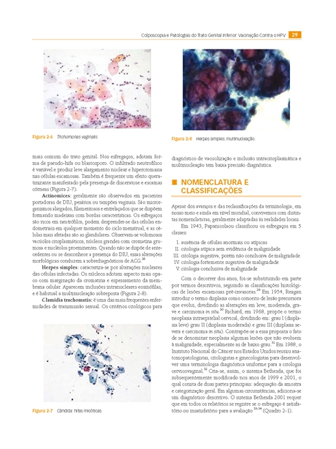 Colposcopia e Patologias do Trato Genital Inferior