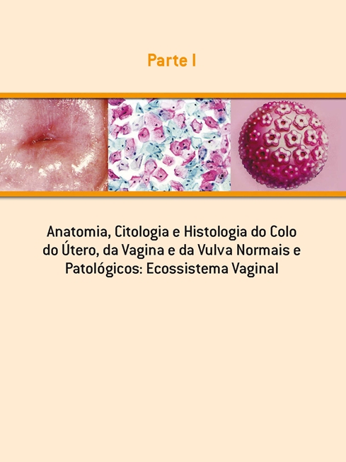 Colposcopia e Patologias do Trato Genital Inferior