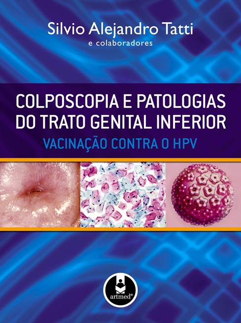 Colposcopia e Patologias do Trato Genital Inferior