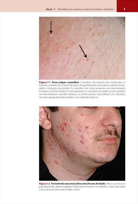 Dermatologia de Fitzpatrick