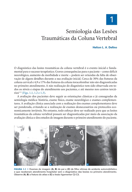 Coluna Vertebral