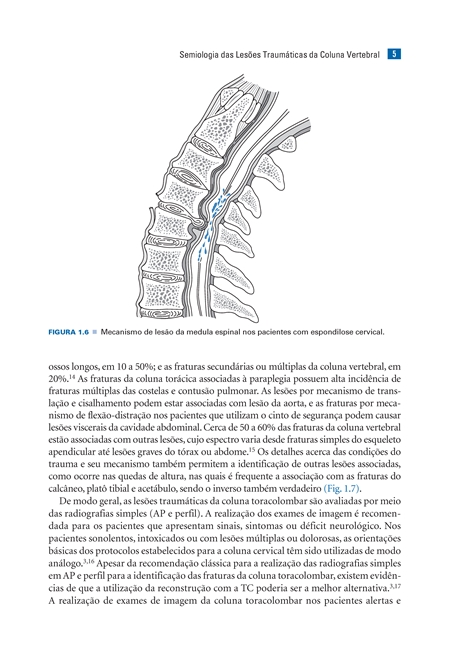 Coluna Vertebral