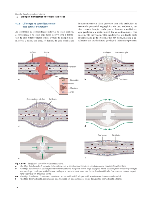 Princípios AO do Tratamento de Fraturas - 2 Volumes