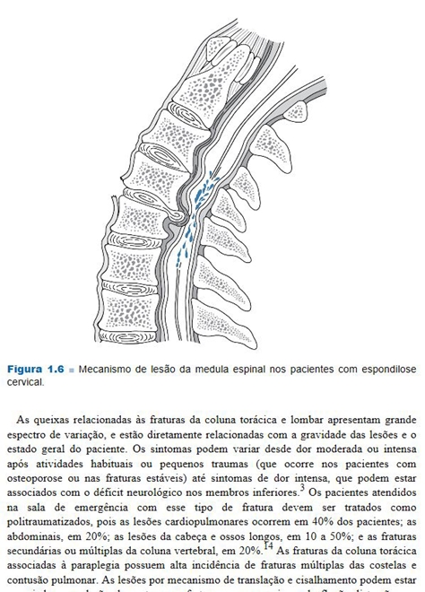 Coluna Vertebral