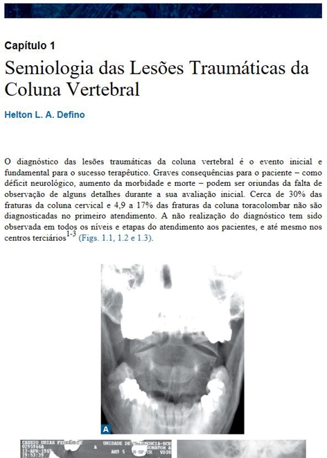 Coluna Vertebral