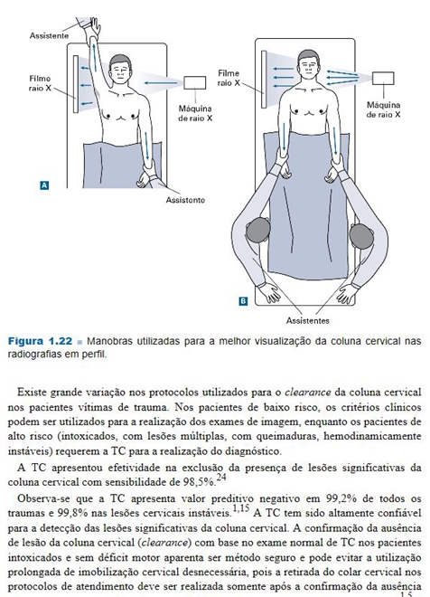 Coluna Vertebral