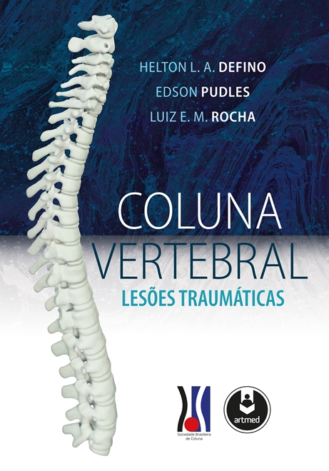 Coluna Vertebral