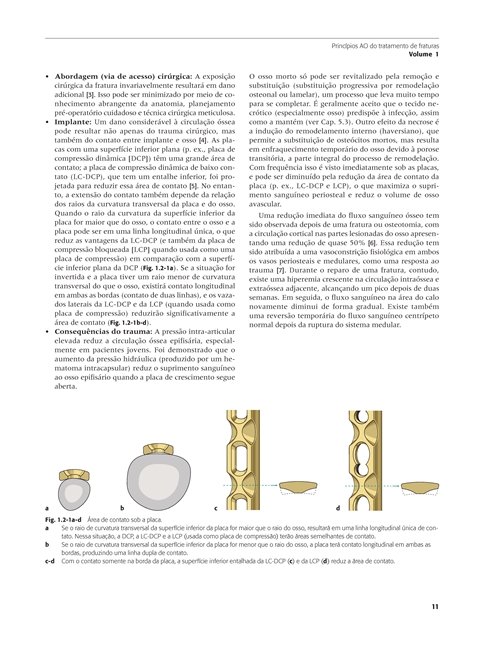 Princípios AO do Tratamento de Fraturas - 2 Volumes