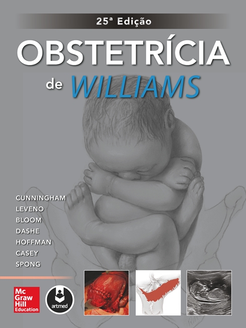 Obstetrícia de Williams