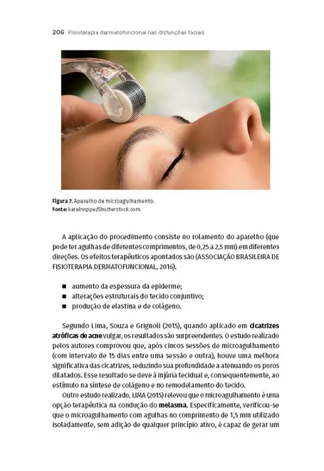 Fisioterapia Dermatofuncional