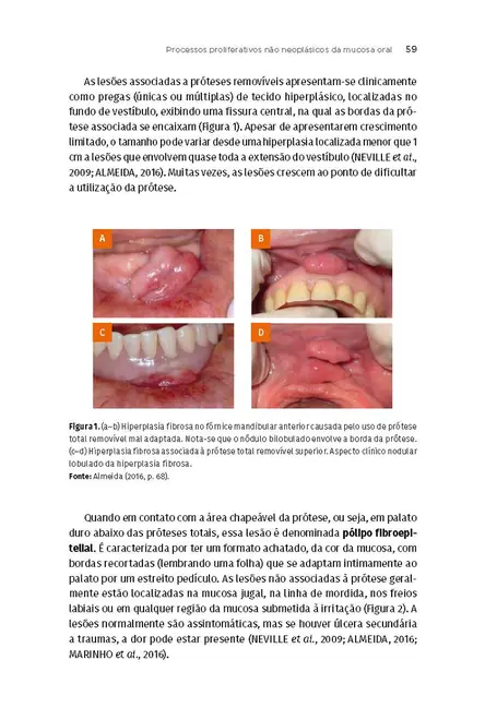 Patologia Oral e Maxilofacial