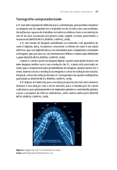 Radiologia e Imaginologia Odontológica