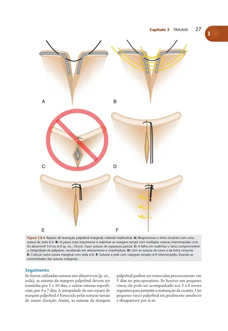 Manual de Doenças Oculares do Wills Eye Hospital