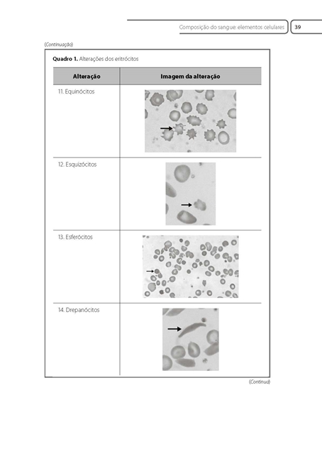 Hematologia Básica