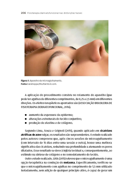 Fisioterapia Dermatofuncional