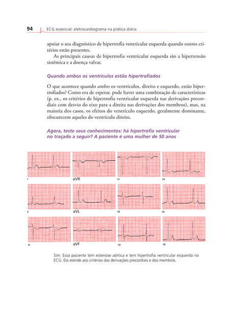 ECG Essencial