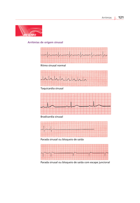 ECG Essencial