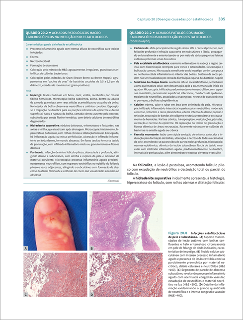 Doenças Infecciosas