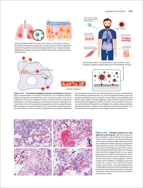 Doenças Infecciosas