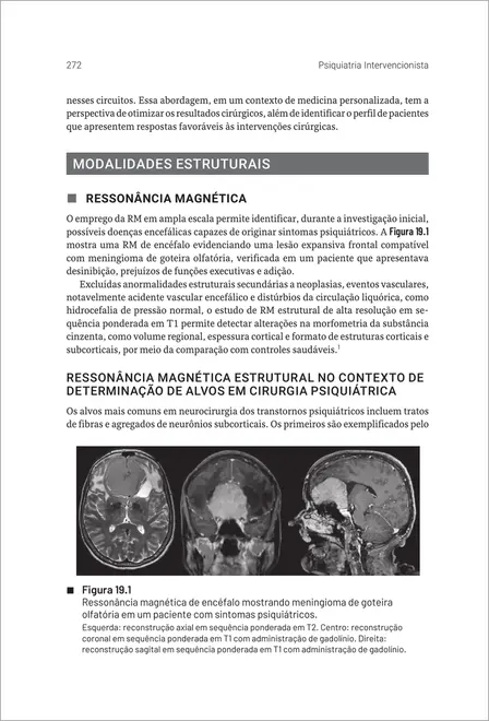 Psiquiatria Intervencionista