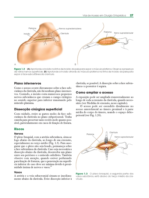 Vias de Acesso em Cirurgia Ortopedica