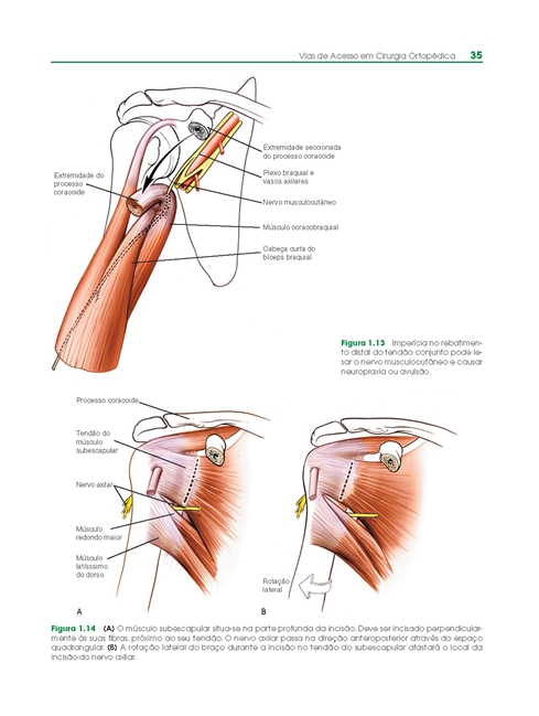 Vias de Acesso em Cirurgia Ortopedica