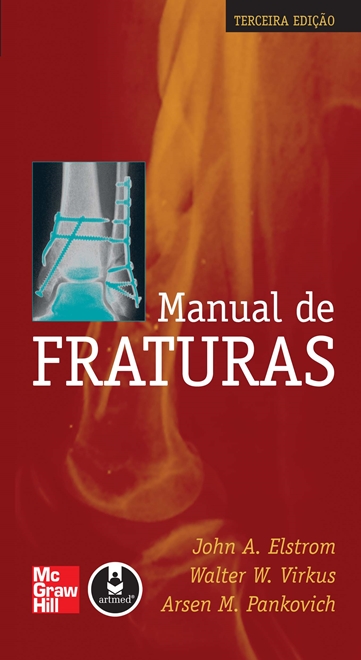 Manual de Fraturas