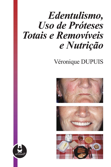 Edentulismo, Uso de Próteses Totais e Removíveis e Nutrição