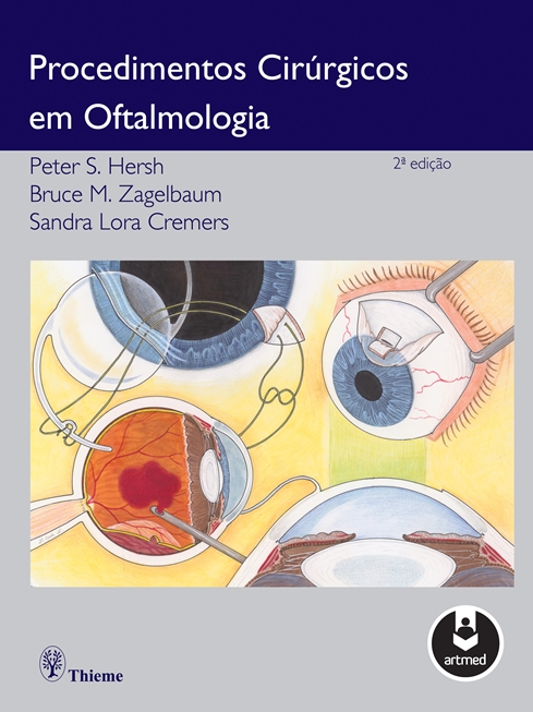 Procedimentos Cirúrgicos em Oftalmologia