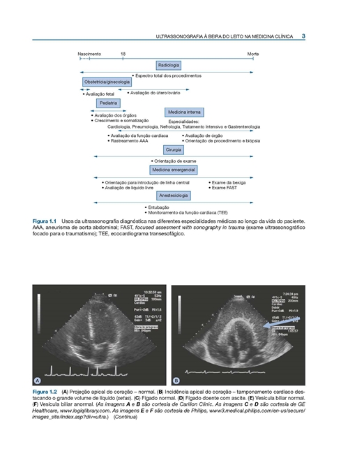 Ultrassonografia à Beira do Leito na Medicina Clínica