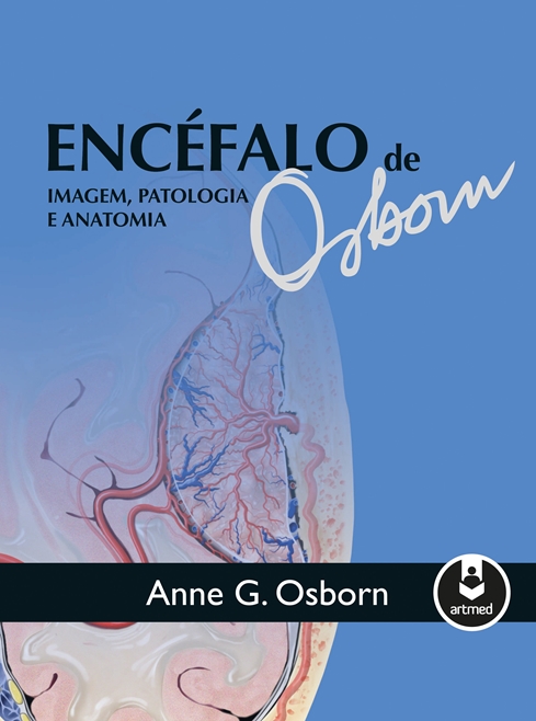 Encéfalo de Osborn