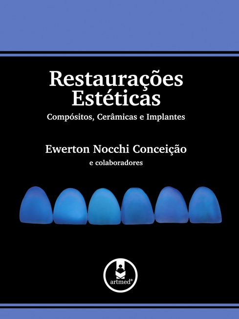 Restaurações Estéticas