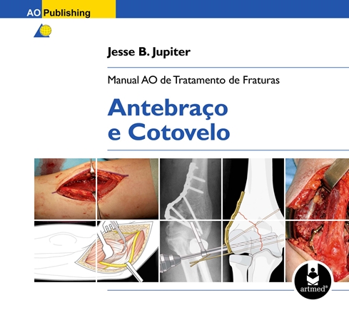 Manual AO de Tratamento de Fraturas