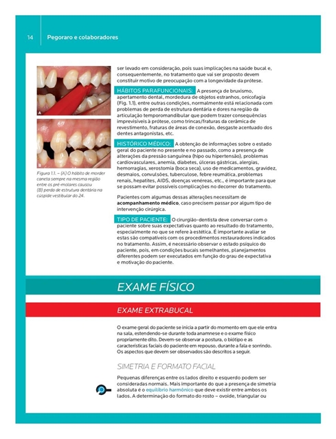 Fundamentos de Prótese Fixa