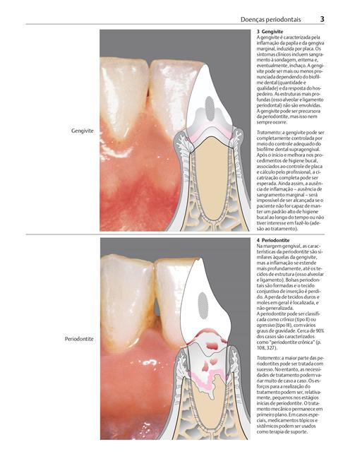 Manual de Periodontia