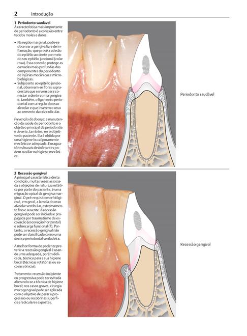 Manual de Periodontia