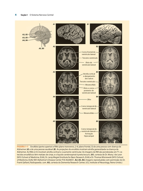 Neuroanatomia