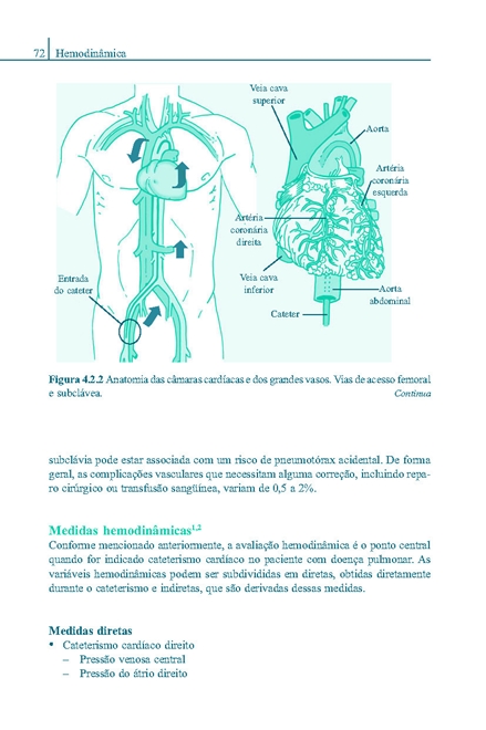 Tromboembolia Pulmonar