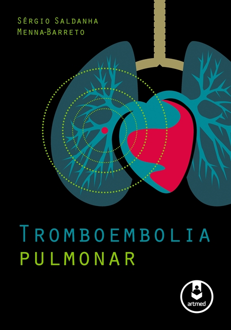 Tromboembolia Pulmonar