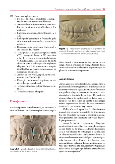 Protocolos para Restaurações Estéticas Previsíveis