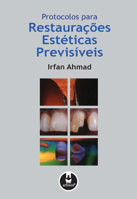 Protocolos para Restaurações Estéticas Previsíveis