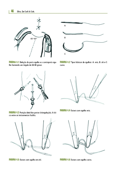 Videocirurgia