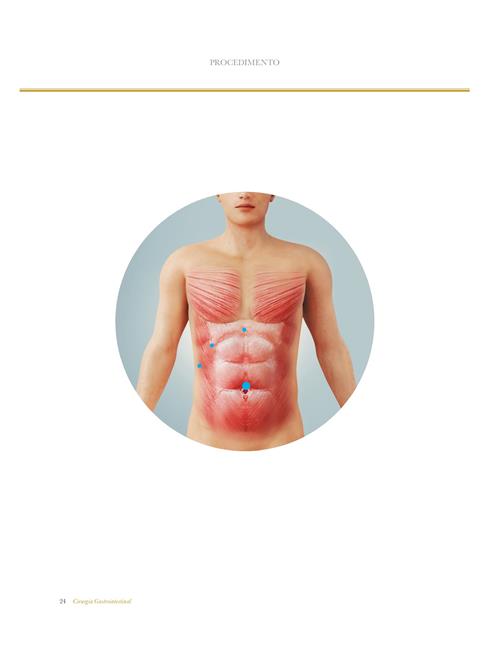 Atlas de Cirurgia Minimamente Invasiva e Robótica