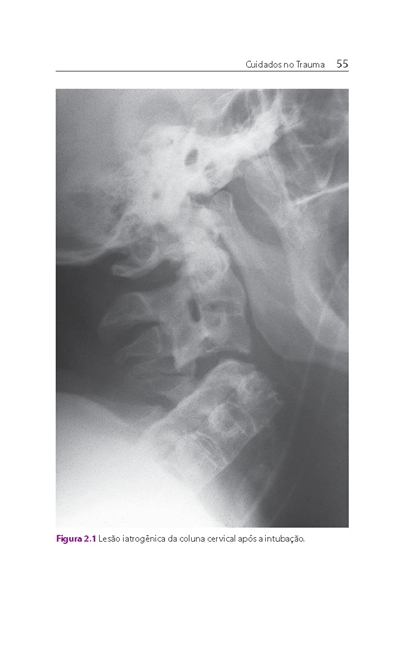 Cuidados no Trauma em Enfermagem