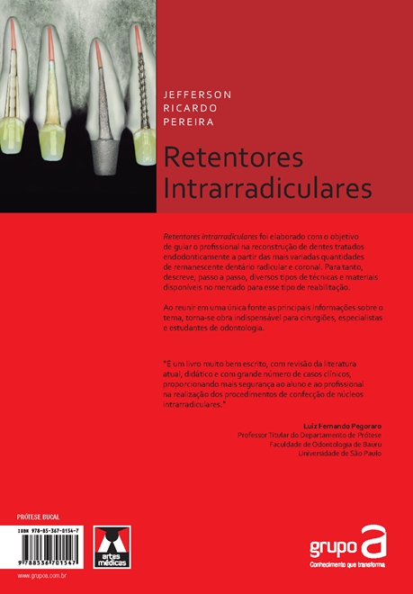 Retentores Intrarradiculares