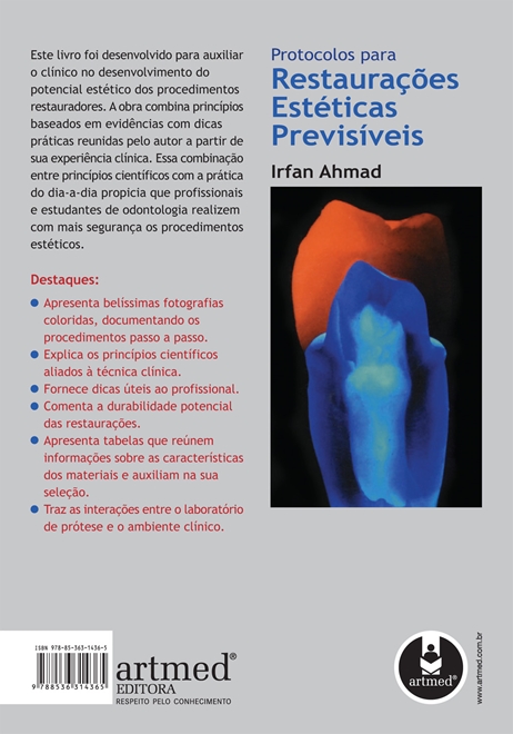 Protocolos para Restaurações Estéticas Previsíveis