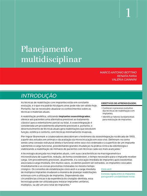 Noções de Prótese Sobre Implante