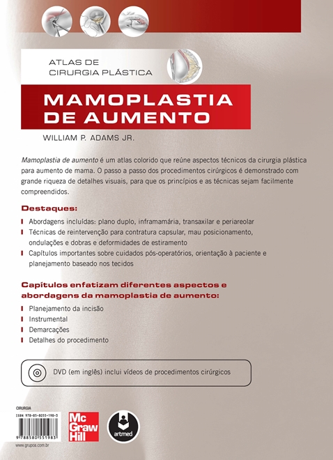 Mamoplastia de Aumento