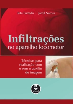 Infiltrações do Aparelho Locomotor