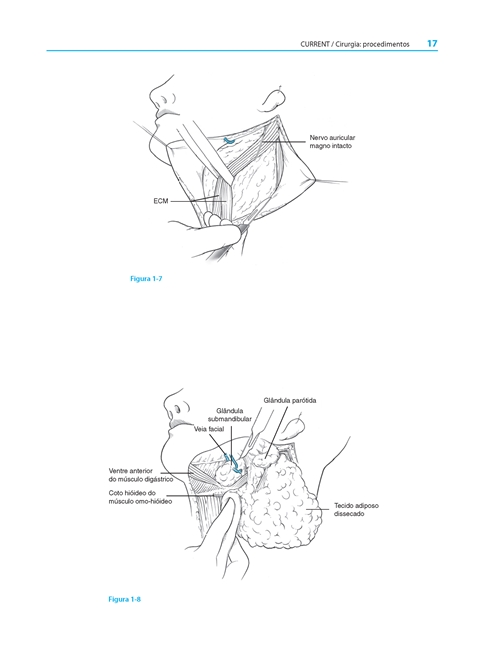 Cirurgia